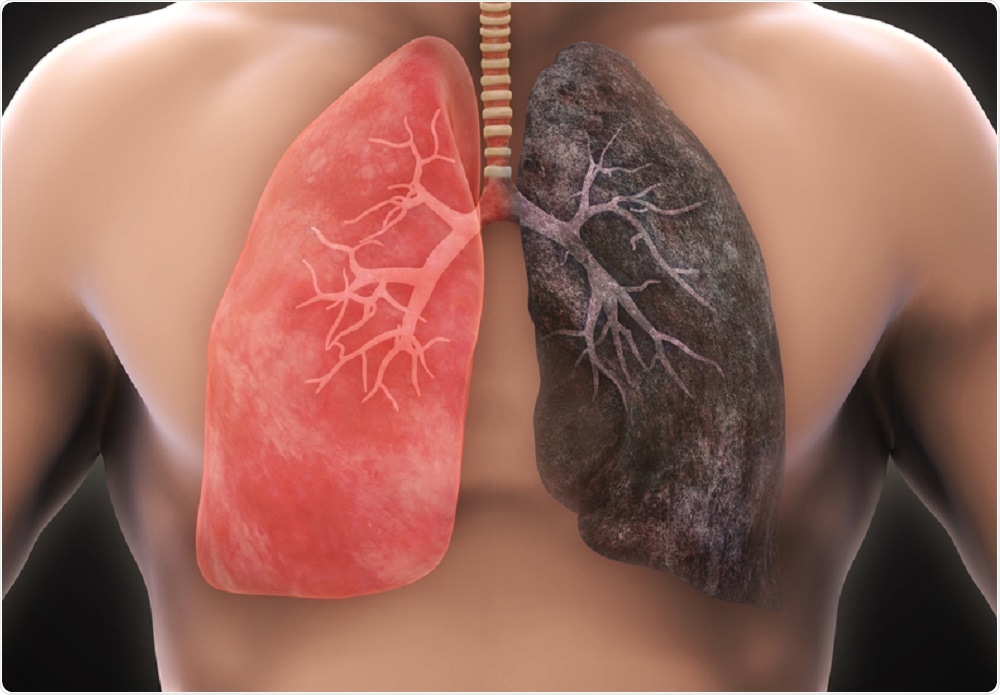 World Lung Cancer Day 2025_3.1